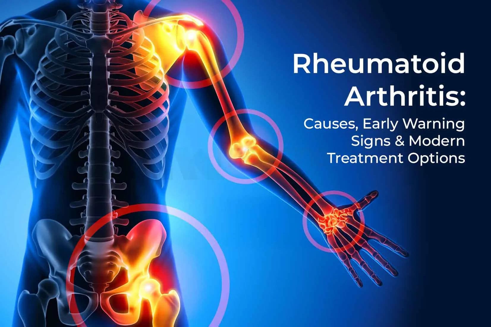 Rheumatoid Arthritis: Causes, Early Warning Signs & Modern Treatment Options