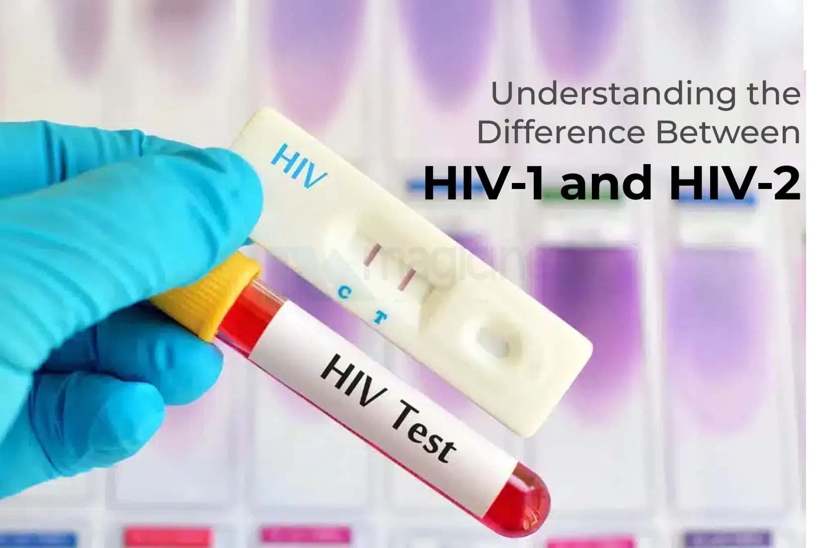 Understanding the Difference Between HIV-1 and HIV-2