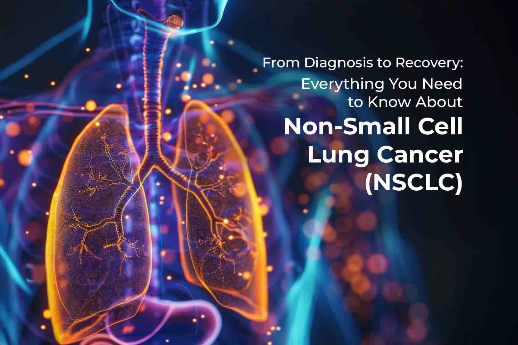 From Diagnosis to Recovery: Everything You Need to Know About Non-Small Cell Lung Cancer (NSCLC)