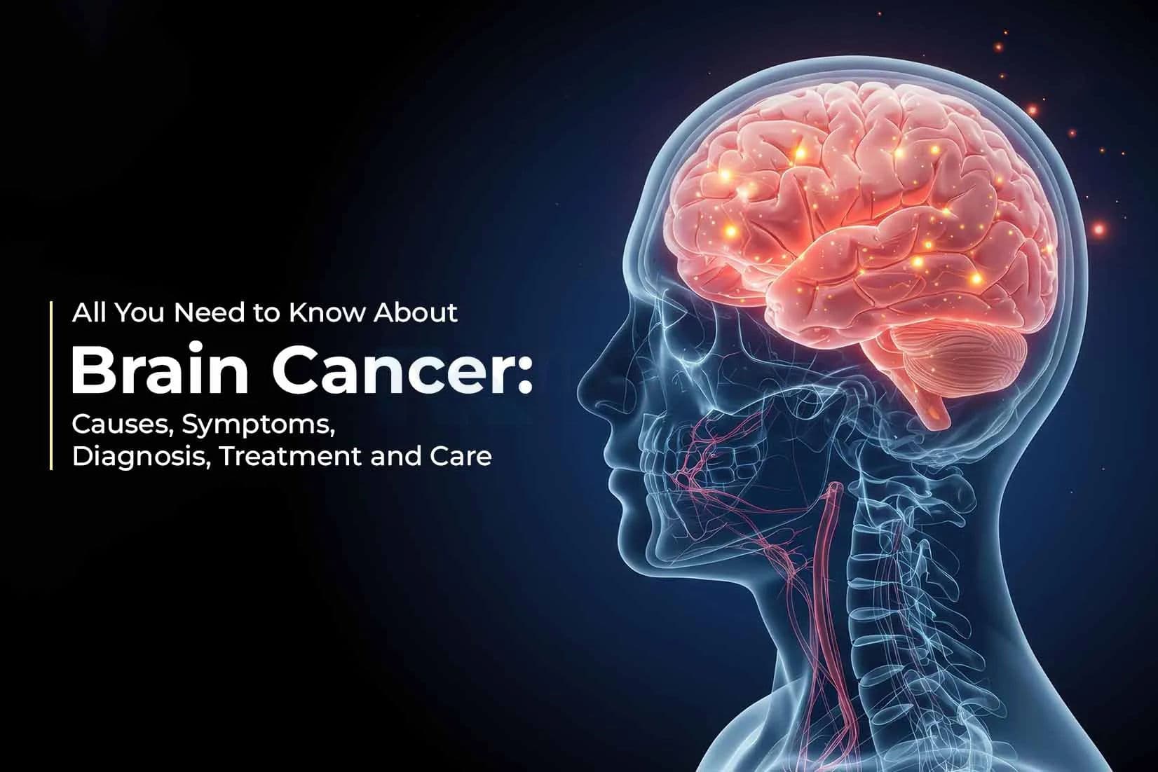 All You Need to Know About Brain Cancer: Causes, Symptoms, Diagnosis, Treatment and Care