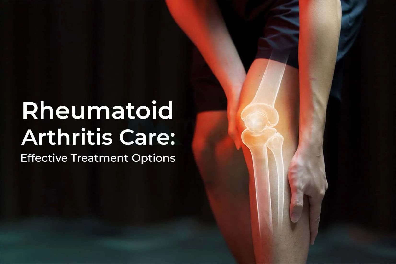 Rheumatoid Arthritis Care: Effective Treatment Options