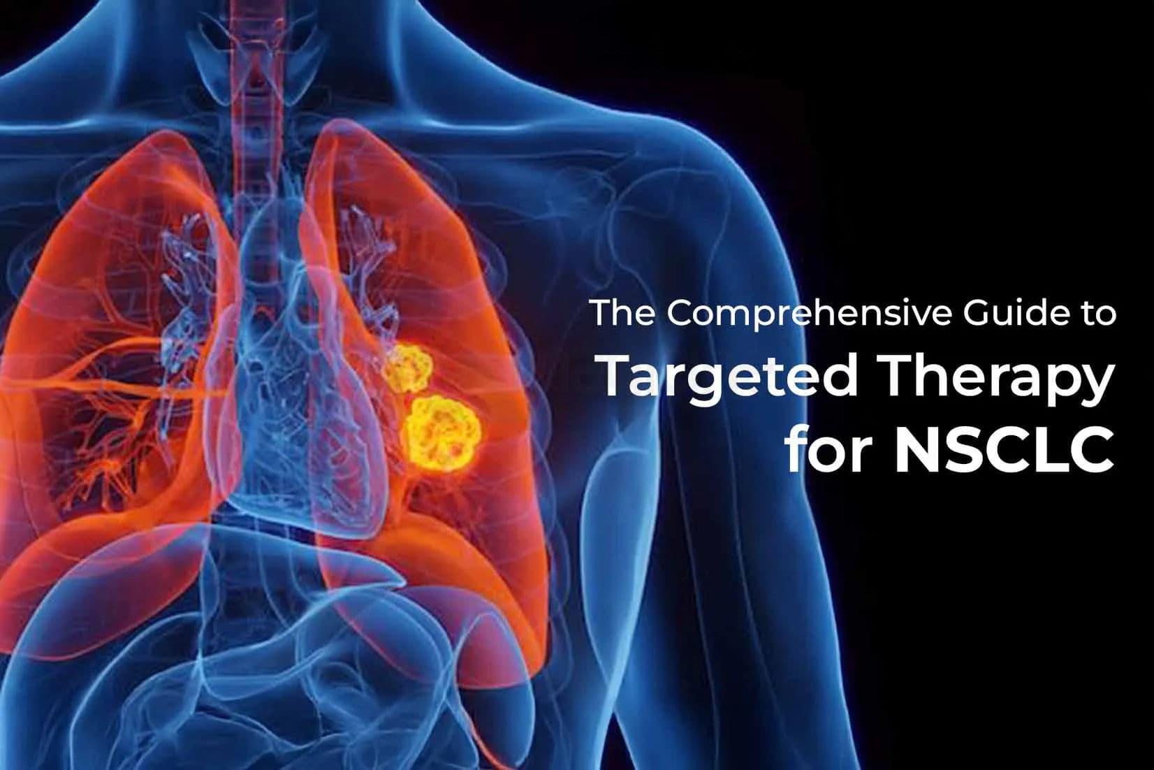 The Comprehensive Guide to Targeted Therapy for NSCLC