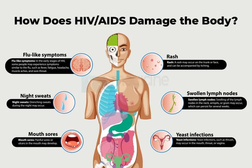 How Does HIV/AIDS Damage the Body?